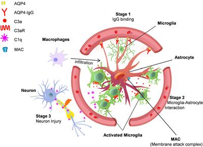 The Emerging Role of Microglia in Neuromyelitis Optica